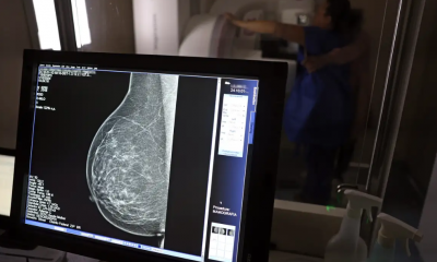 Desigualdade no acesso a mamgrafos compromete diagnstico precoce do cncer de mama