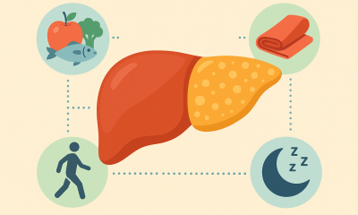 Gordura no f�gado j� atinge 30% dos adultos: especialistas explicam como reverter antes que vire doen�a grave