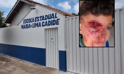 Aluno ferido ap�s ataque em escola de Rondon�polis tem caso levado � C�mara