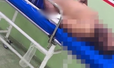 Homem foi esfaqueado após invadir casa da ex-companheira com medida protetiva em Várzea Grande