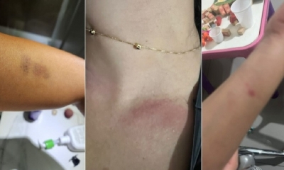 Mulher denuncia agress�es do noivo ap�s discuss�o em Cuiab�