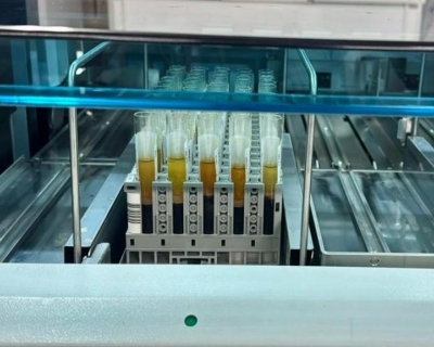 MT Hemocentro realiza 4,8 mil exames para captao de rgos em 12 meses