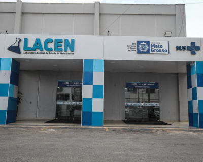 Lacen realiza webinar sobre monitoramento laboratorial de produtos sob controle da Vigilncia Sanitria