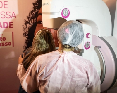 SES orienta sobre nova regra que antecipa mamografia para mulheres com mais de 40 anos