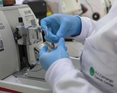 Cresce n�mero de homens com menos de 50 anos em tratamento contra c�ncer de pr�stata