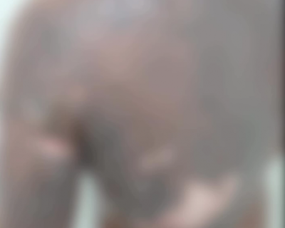 Grupo de adolescentes chama menino de 13 anos para brincar, ateia fogo e filma ataque em Sorriso (V�deo)