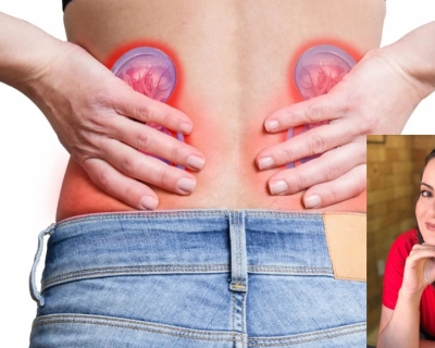 Calculose Renal, a popular pedra nos rins