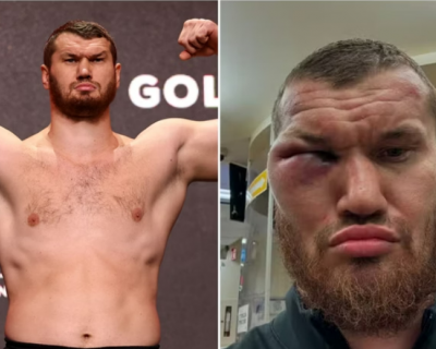 Boxeador russo tem rosto desfigurado aps luta. Veja antes e depois