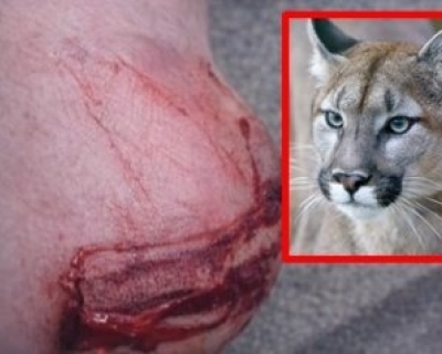 Professora � ferida no calcanhar ap�s ataque de on�a-parda na zona rural de Chapada