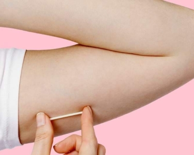 Implanon ganha reforço no SUS com nova etapa de capacitação profissional