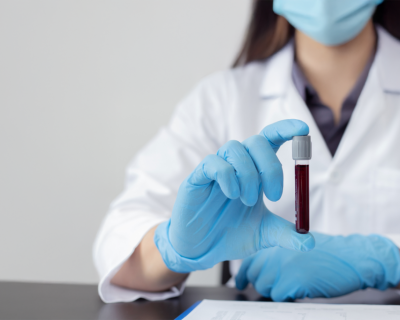 Sem diagnóstico, hemofilia segue como desafio silencioso global