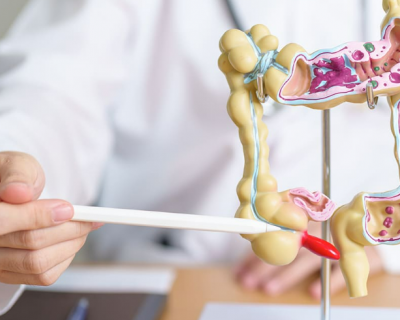 C�ncer Colorretal: Terceiro tipo mais frequente no Brasil requer aten��o e preven��o