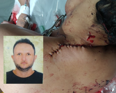 Mulher  golpeada com facadas pelo esposo em Jaciara