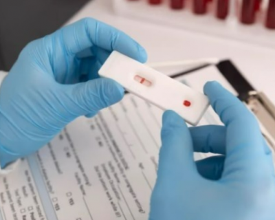 Mato Grosso receber mais de 83 mil testes rpidos para diagnstico de dengue