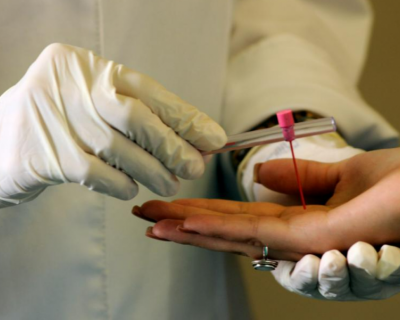 SES intensifica aes e destaca medidas para reduo de casos de hansenase em MT