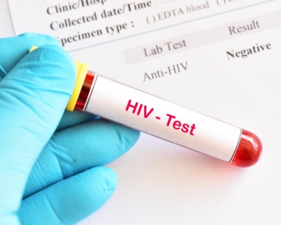 OMS expressa preocupao com suspenso de recursos dos EUA para combate ao HIV