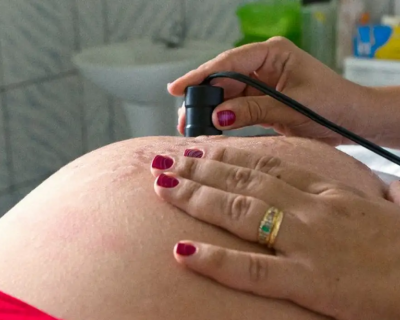 Sade recomenda clcio para todas as gestantes para prevenir eclmpsia
