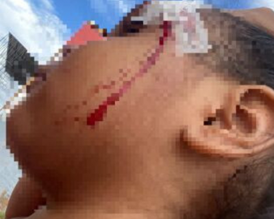 Mulher � presa em flagrante por agredir filha de tr�s anos com cabo de vassoura em V�rzea Grande