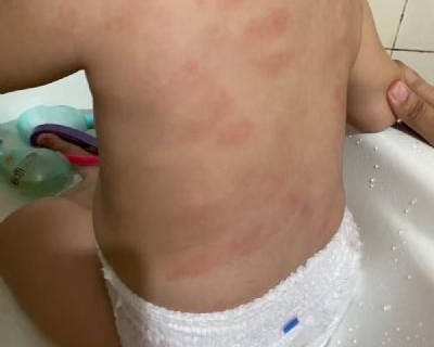 Laudo confirma que beb� de 1 ano foi agredido em creche