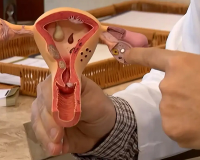 Endometriose: identificando sintomas e opes de tratamento