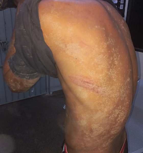 Facção criminosa sequestra e tortura dois homens em área de mata em Cuiabá