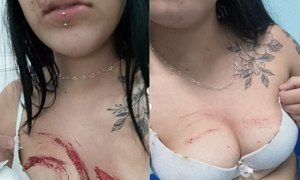 Jovem acorda no mato ensanguentada após aceitar água de desconhecido