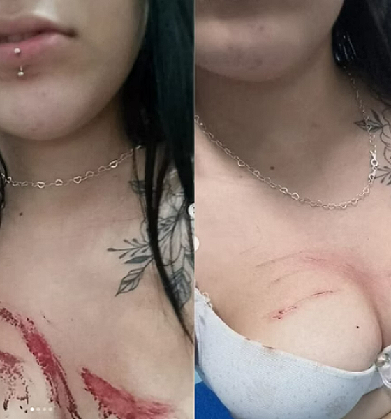 Jovem acorda no mato ensanguentada após aceitar água de desconhecido