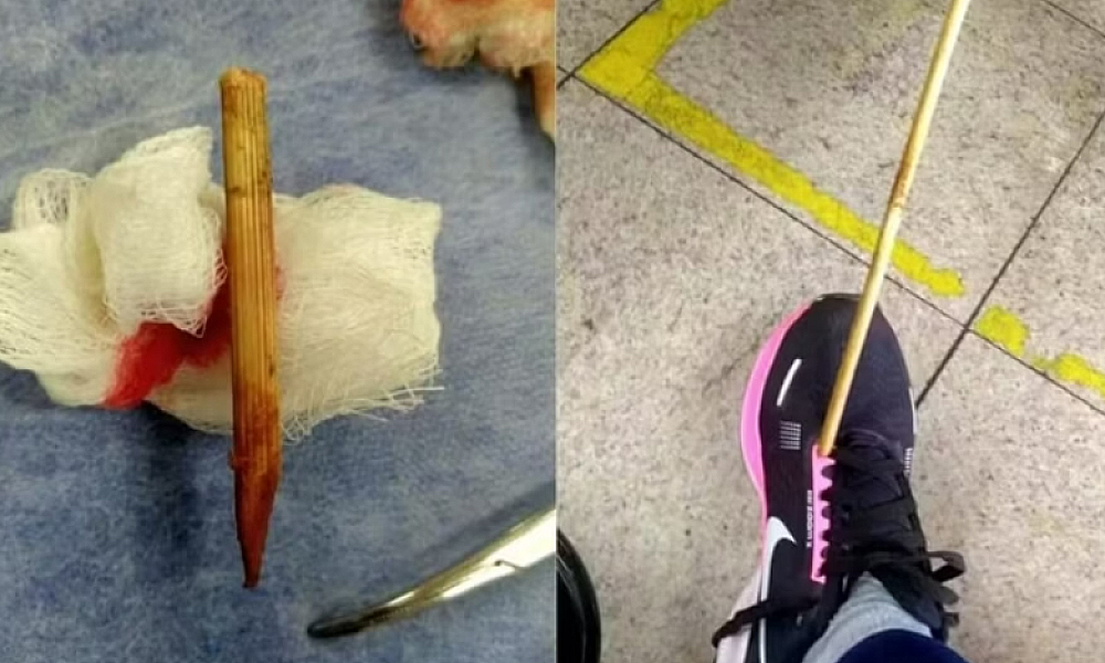 Mulher é atingida por “flecha” enquanto caminhava pela rua em BH