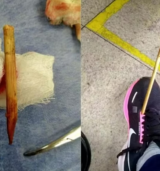 Mulher é atingida por “flecha” enquanto caminhava pela rua em BH