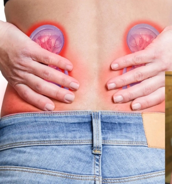 Calculose Renal, a popular pedra nos rins