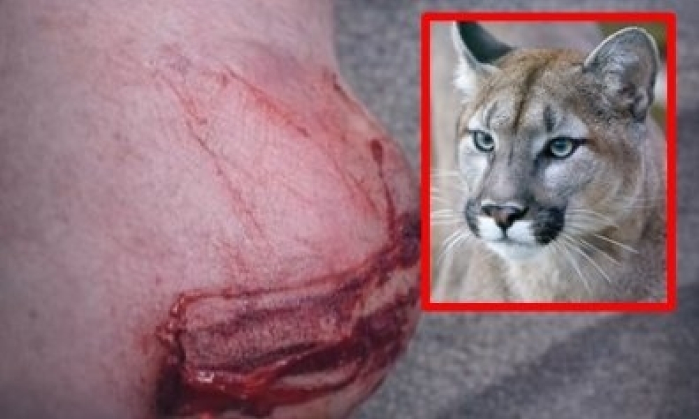 Professora é ferida no calcanhar após ataque de onça-parda na zona rural de Chapada