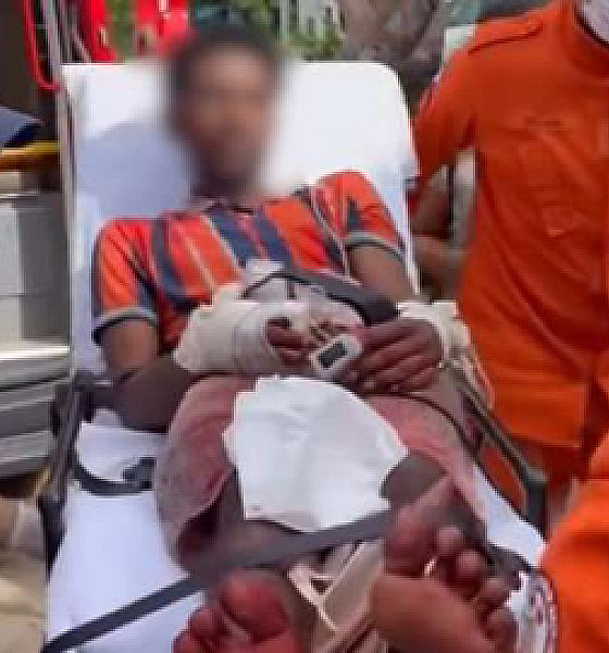 Discussão por suspeita de furto termina com homem ferido a facão em Sorriso