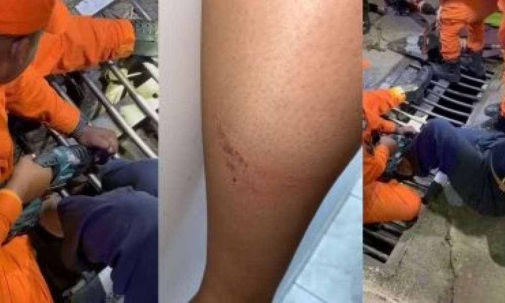 Universitária fica com perna presa em bueiro e é resgatada por bombeiros no Centro de Cuiabá(Vídeo)