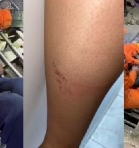 Universitária fica com perna presa em bueiro e é resgatada por bombeiros no Centro de Cuiabá(Vídeo)