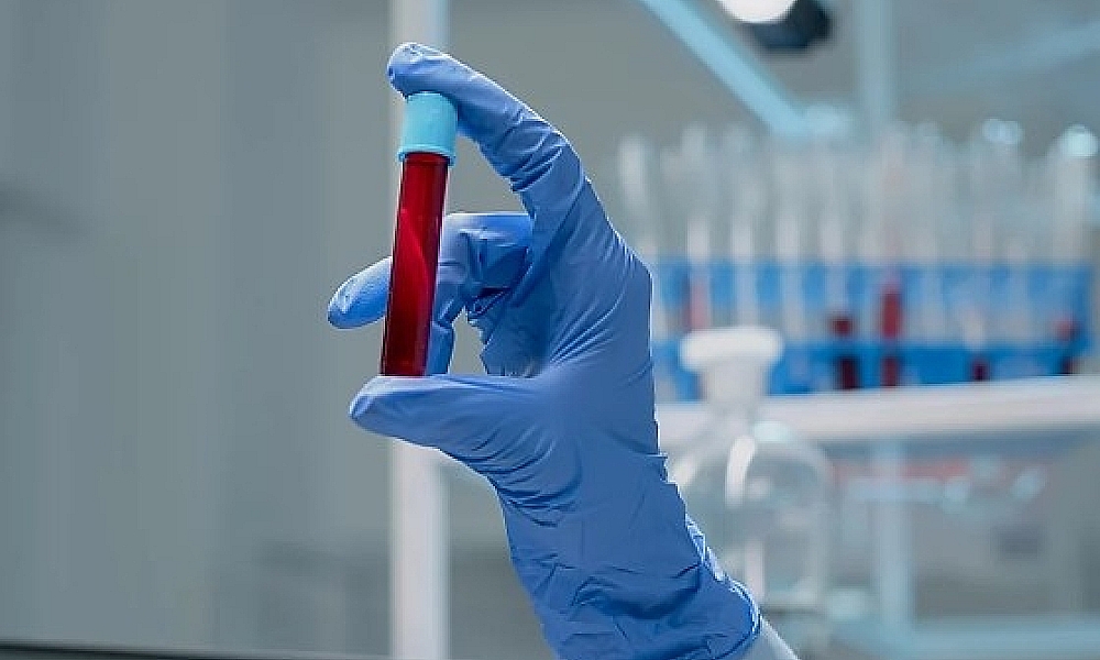 Exame de sangue desenvolvido no Brasil promete auxiliar na detecção precoce do câncer de mama