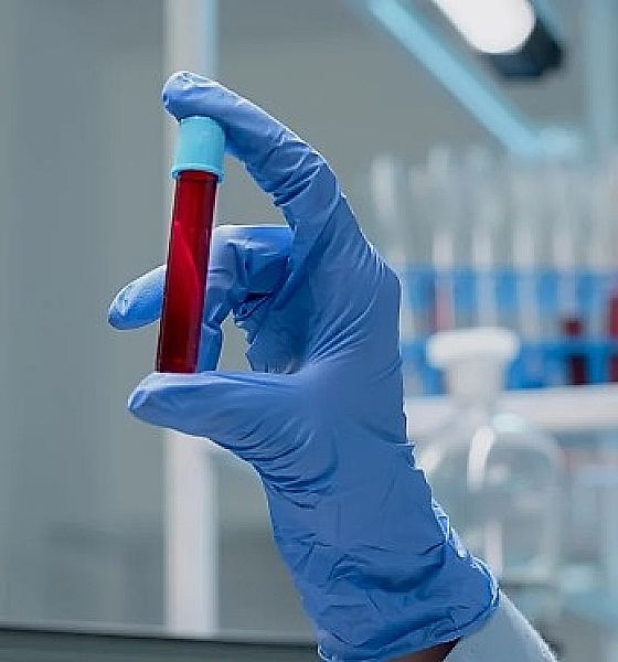 Exame de sangue desenvolvido no Brasil promete auxiliar na detecção precoce do câncer de mama