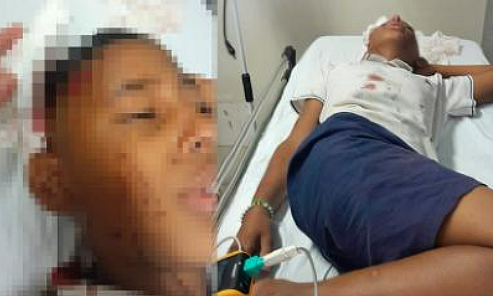 Criança tem crânio quebrado após levar paulada de colega de escola