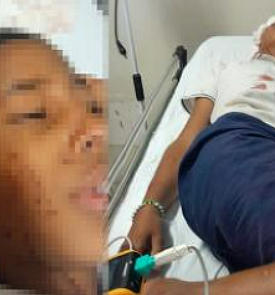 Criança tem crânio quebrado após levar paulada de colega de escola