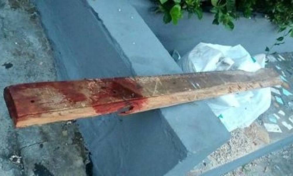 Criminoso invade casa e espanca homem de 42 anos no interior de MT