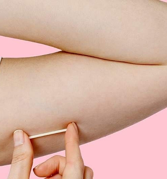 Implanon ganha reforço no SUS com nova etapa de capacitação profissional