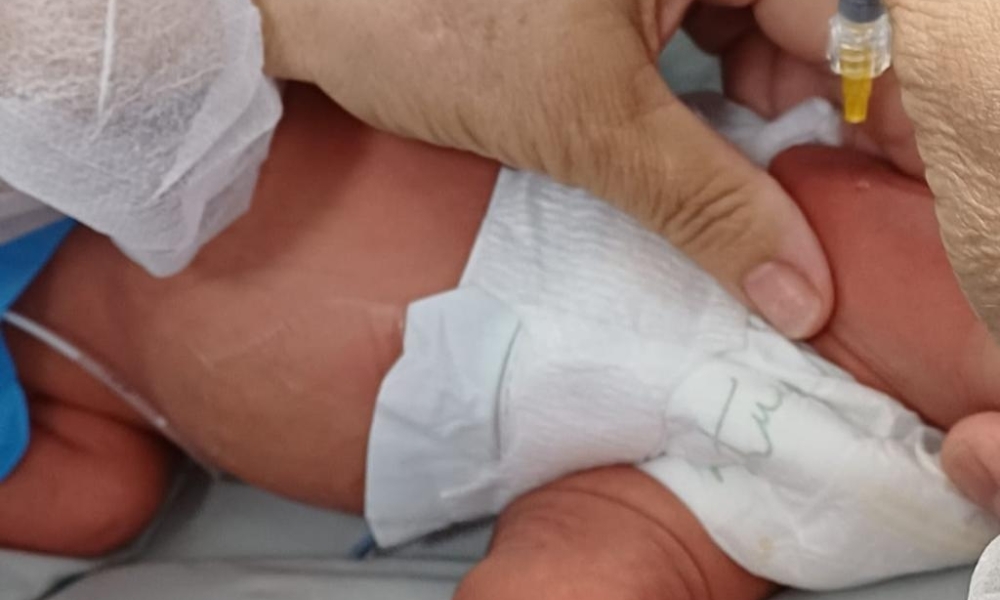 Hospitais estaduais oferecem proteção contra bronquiolite a bebês prematuros