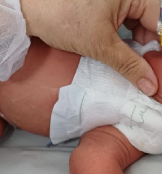 Hospitais estaduais oferecem proteção contra bronquiolite a bebês prematuros