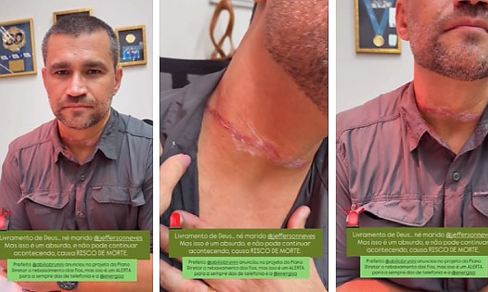 Fio solto atinge pescoço de secretário e expõe risco grave em Cuiabá (Vídeo)