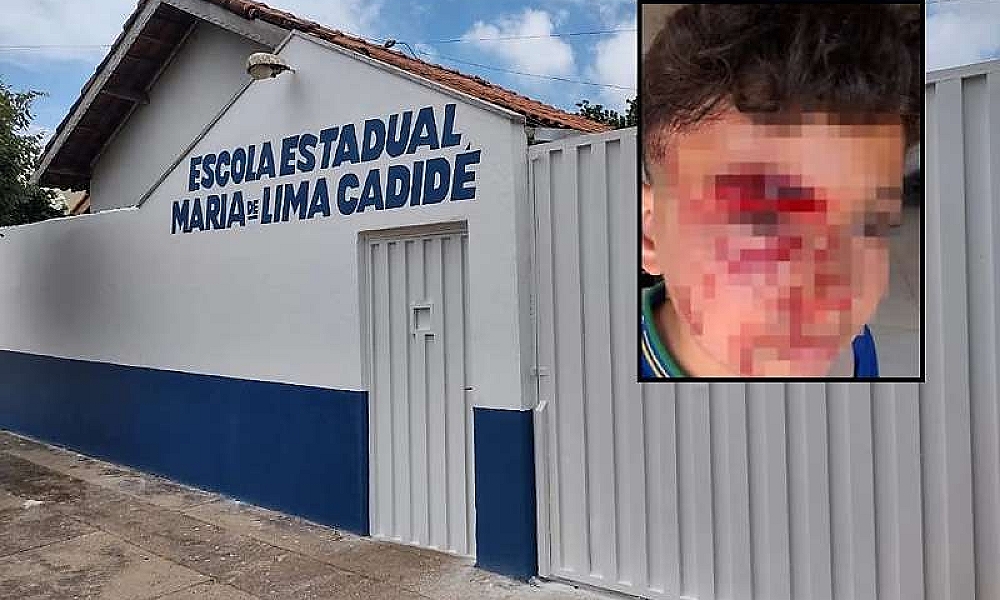 Aluno ferido após ataque em escola de Rondonópolis tem caso levado à Câmara