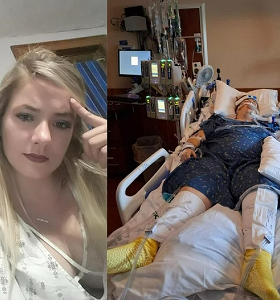 Mulher fica 11 dias em coma após colapso pulmonar causado por vape