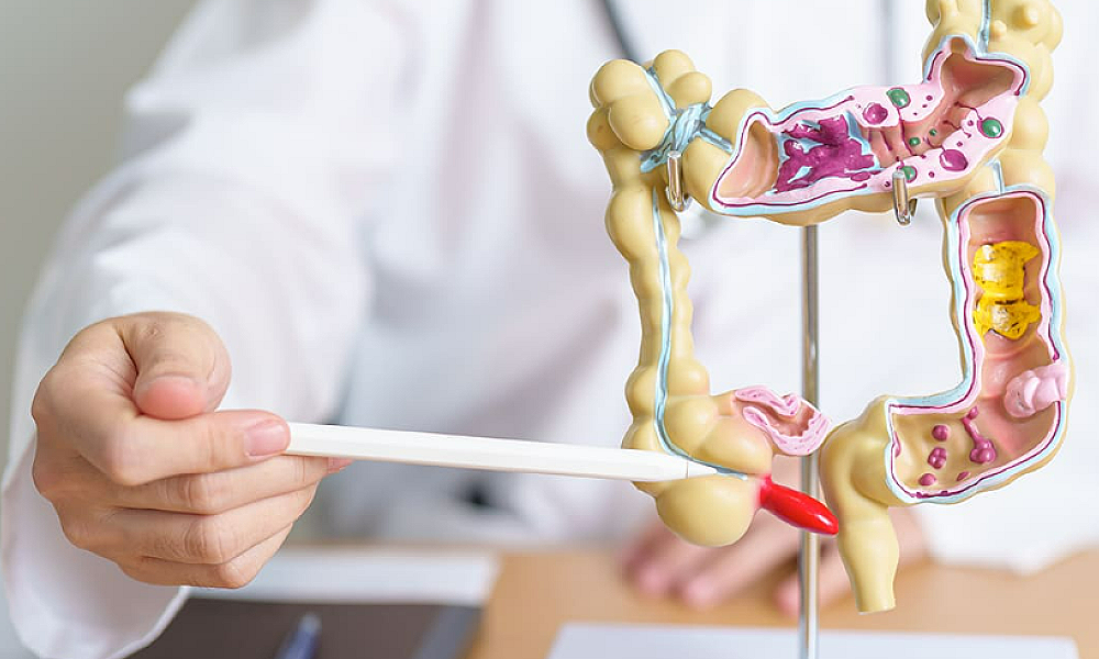 Câncer Colorretal: Terceiro tipo mais frequente no Brasil requer atenção e prevenção