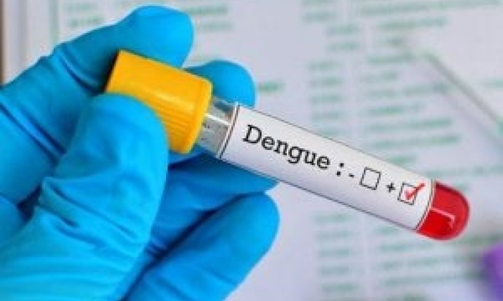 Mato Grosso registrou 24.871 casos de dengue em 2024, conforme os dados divulgados pelo Ministério da Saúde na tarde dessa terça-feira (30). No rankin