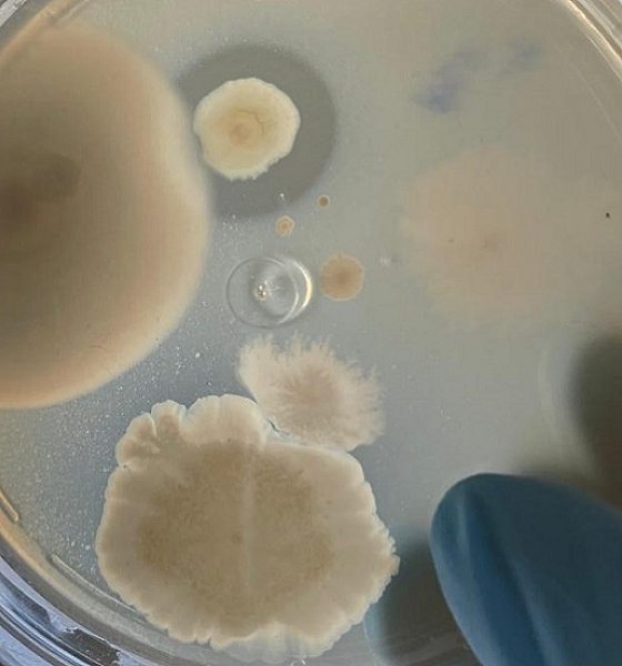 Bactérias da Amazônia podem ser usadas para desenvolver novos antibióticos