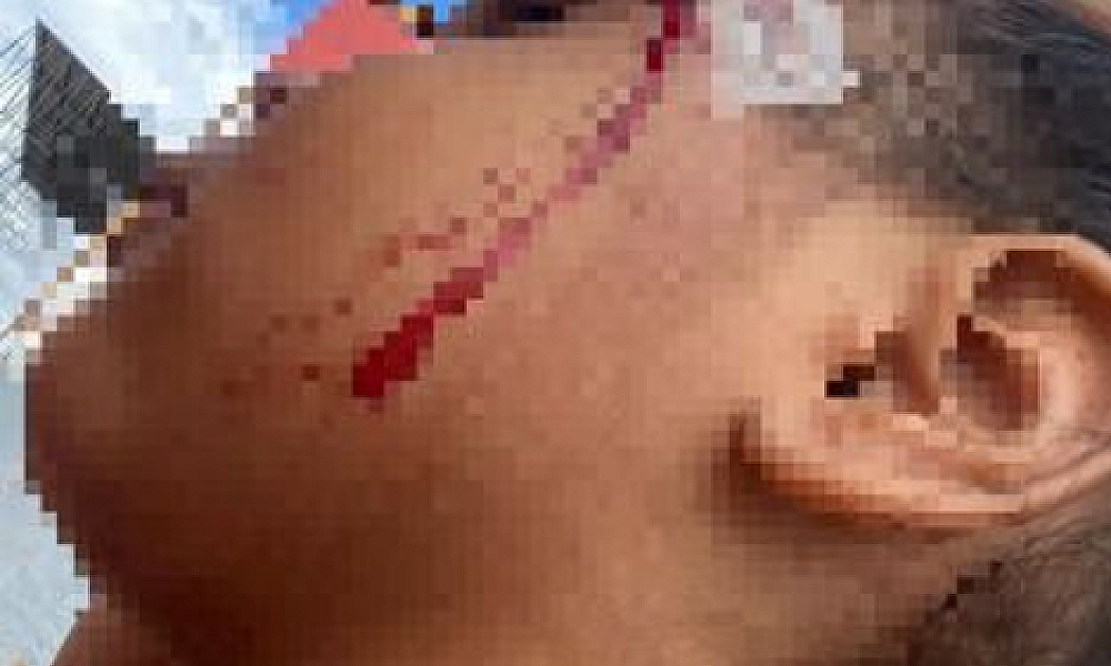 Mulher é presa em flagrante por agredir filha de três anos com cabo de vassoura em Várzea Grande