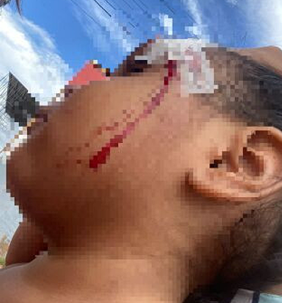 Mulher é presa em flagrante por agredir filha de três anos com cabo de vassoura em Várzea Grande